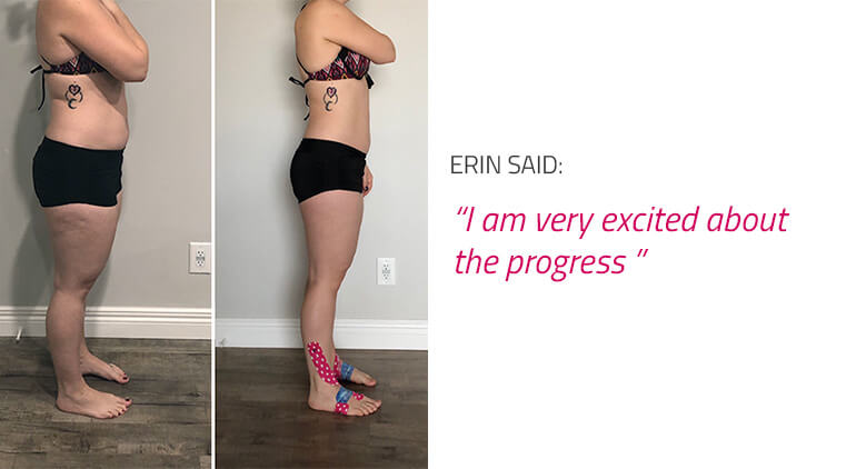 endomorph girl before and after body photo results