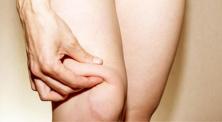 what causes knee fat