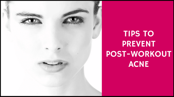 tips to prevent post workout acne